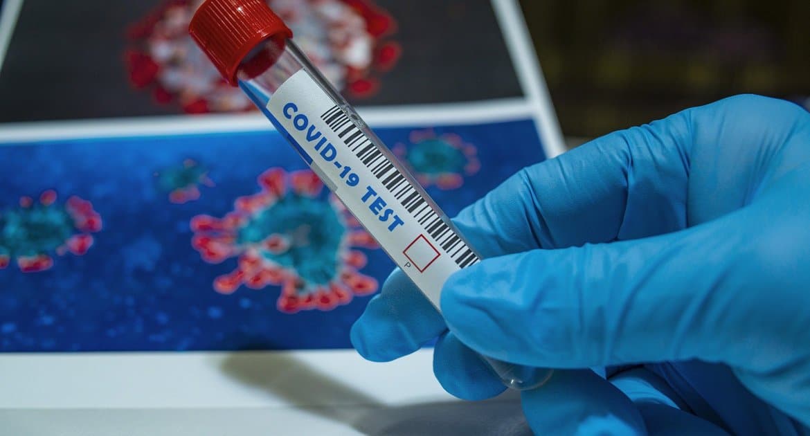 За сутки в России выявили почти 21 тысячу больных коронавирусом