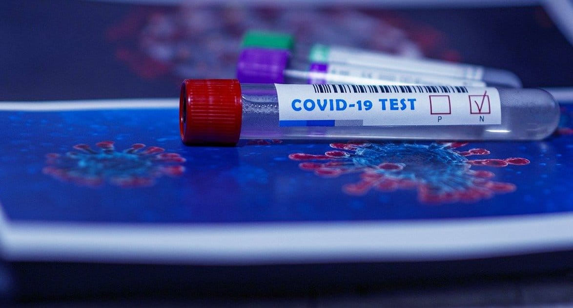 Митрополит Псковский Тихон передал региону 15 тысяч экспресс-тестов на коронавирус