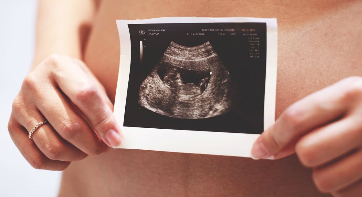 Гомельским роженицам, желающим сделать аборт, предложат послушать сердцебиение ребенка