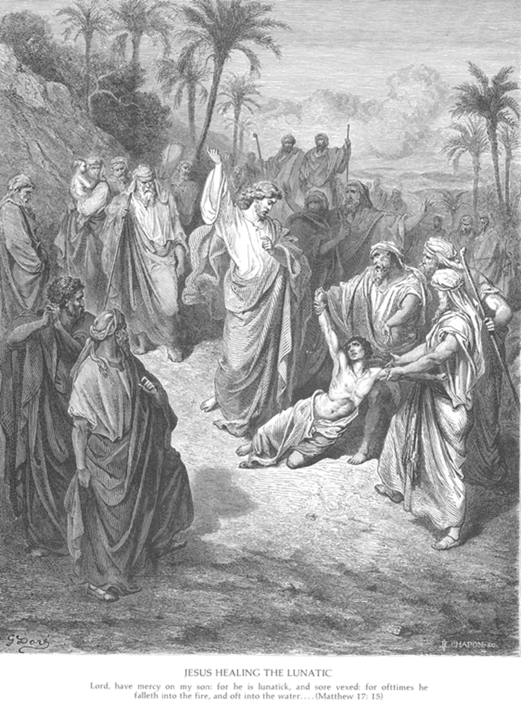 В Евангелии упомянуты непонятные болезни. О чём идёт речь?